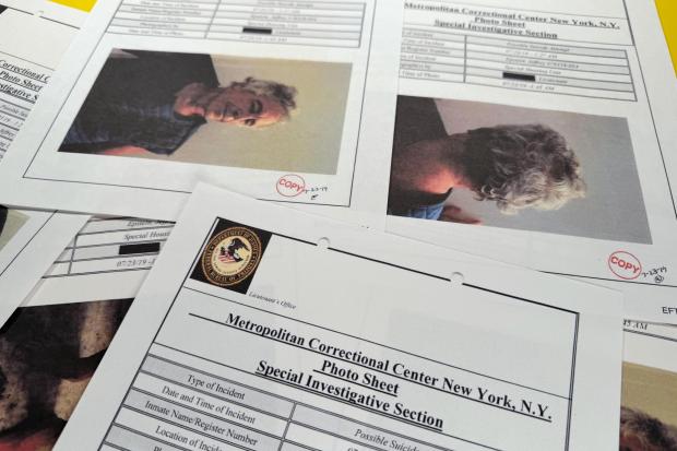A document that was included in the U.S. Department of Justice release of the Jeffrey Epstein files, photographed Tuesday, Feb. 10, 2026, shows a Metropolitan Correctional Center report with photos of Epstein after a suicide attempt on July 23, 2019. (AP Photo/Jon Elswick)
