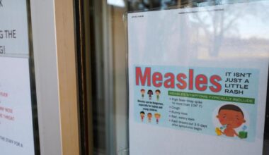 Health officials warn of possible measles exposure at LAX, Disneyland – Redlands Daily Facts