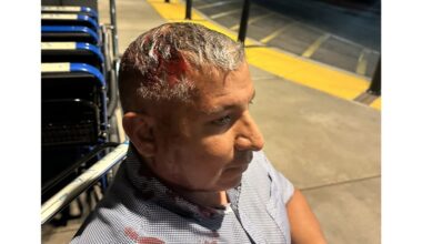 Man shot in the head with ‘less-than-lethal’ round at OC protest was victim of excessive force, lawsuit claims – Redlands Daily Facts