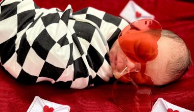 Local hospital’s NICU babies ready for Valentine’s Day – NBC Los Angeles