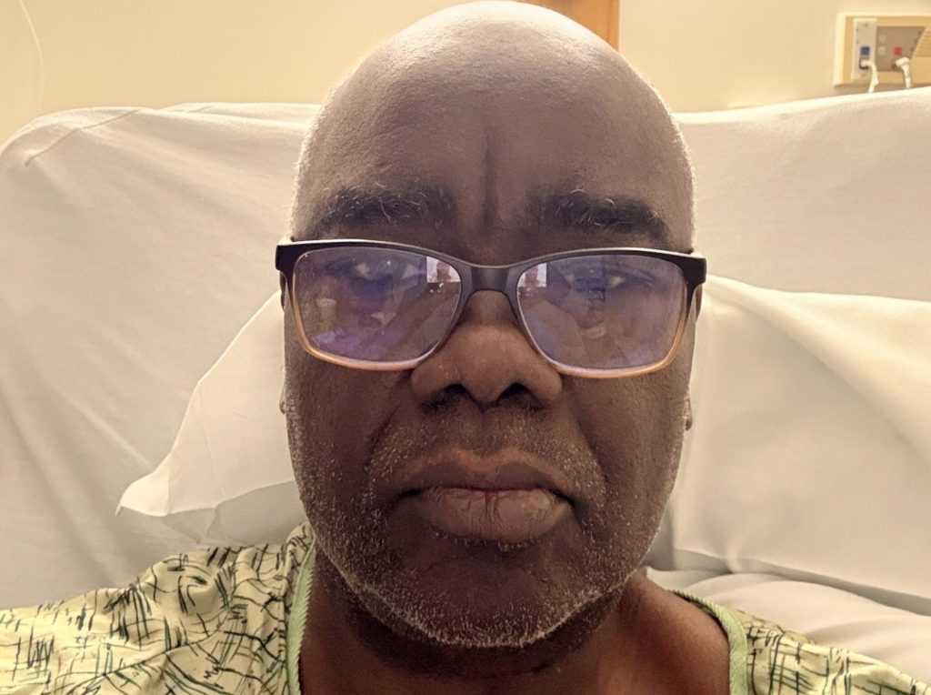 My case shows why Black men need to worry about prostate cancer – San Diego Union-Tribune