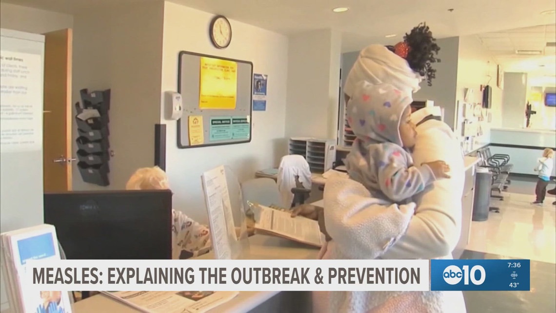 Recent measles cases in California possibly linked to Disneyland visit, health officials say