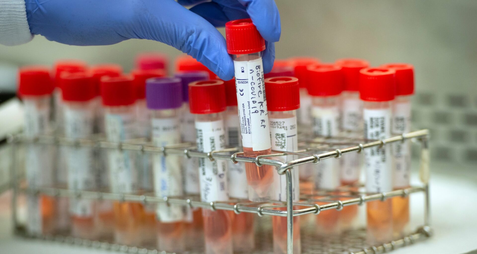 Long Beach settles employee's lawsuit over religious exemption for coronavirus testing • Long Beach Post News