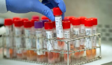 Long Beach settles employee's lawsuit over religious exemption for coronavirus testing • Long Beach Post News