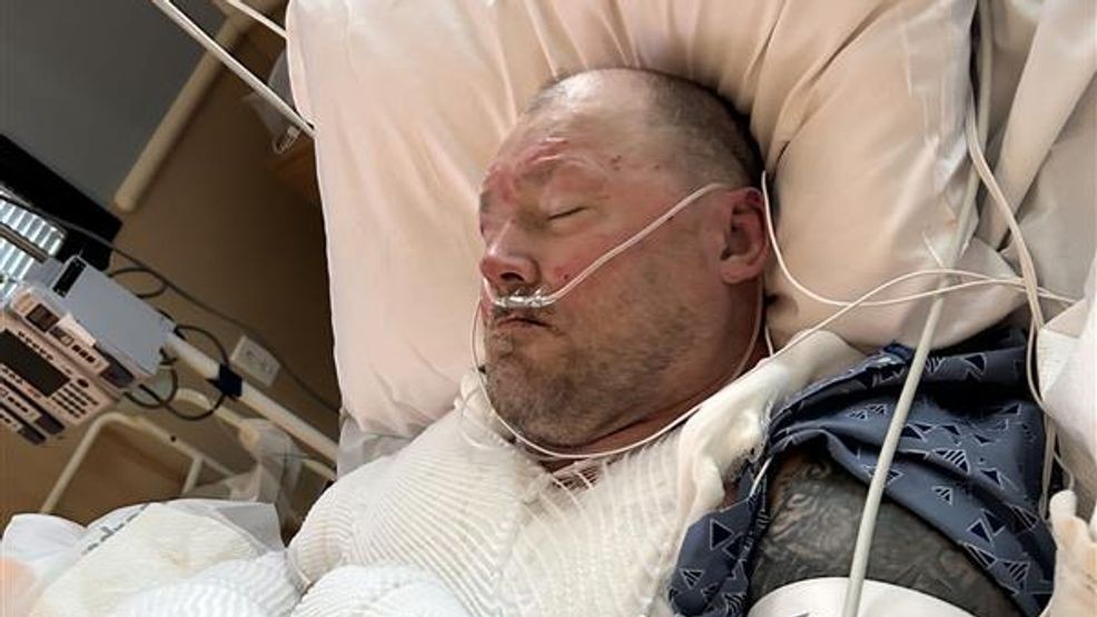 On January 22, 2026, a woman allegedly set Billy Terry on fire after throwing gas on him. The accused, allegedly worked at Terry's brand new Hungry Grizzly Bear Company restaurant in Taft. Photo Credit: Willella Gorden