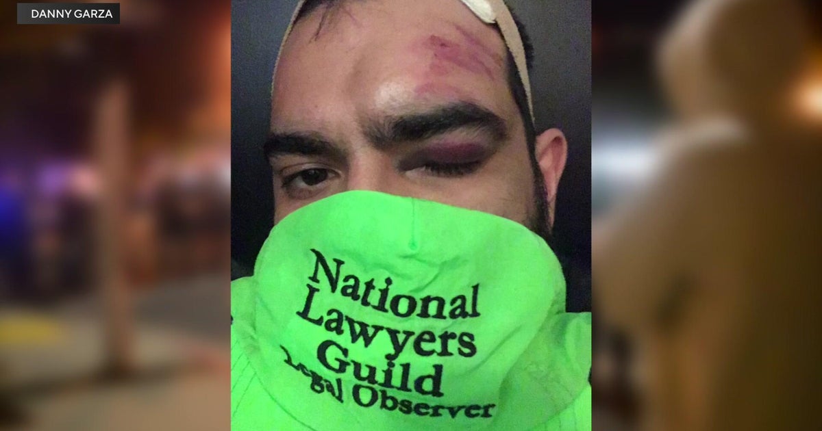 Sacramento to pay $2.2 million to man injured by police during George Floyd protests