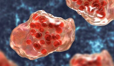 Los Angeles County confirms fourth measles case of the year in LAX traveler