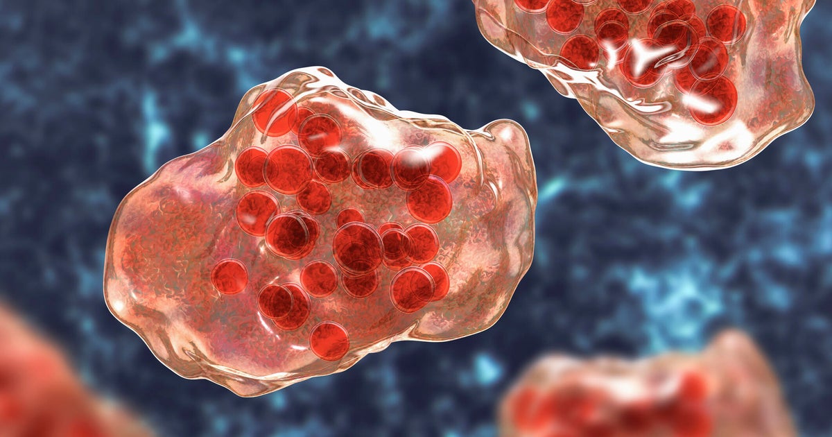 Los Angeles County confirms fourth measles case of the year in LAX traveler