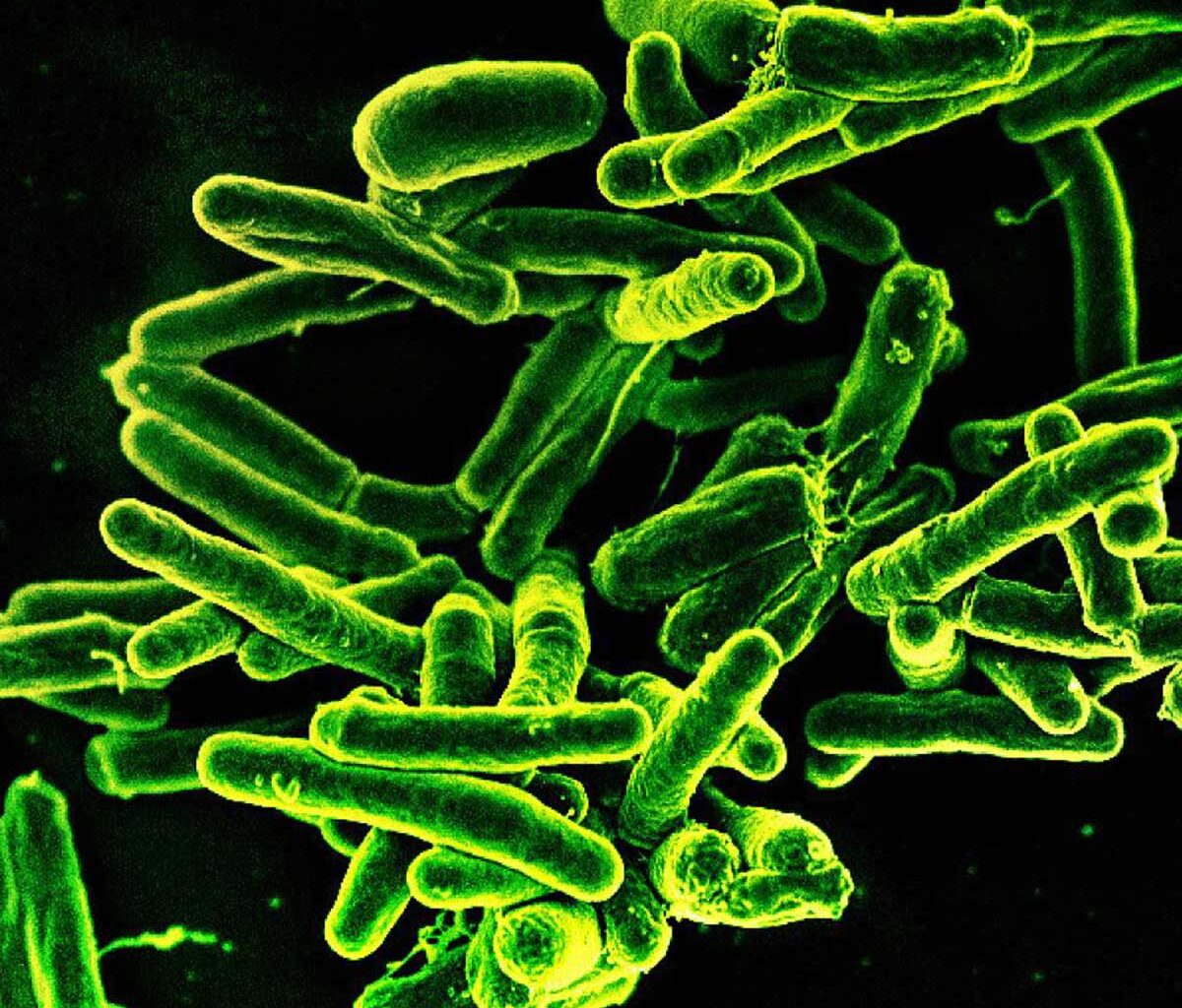 Active v. Latent TB: What to Know About the San Francisco Outbreak