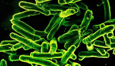 Active v. Latent TB: What to Know About the San Francisco Outbreak