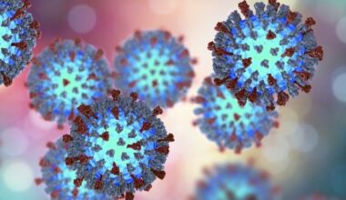 5 Places LA County Residents May Have Been Exposed To Measles