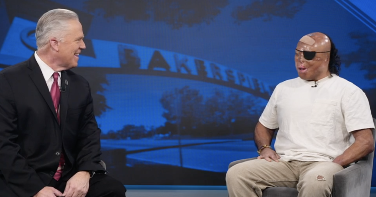 Bakersfield burn survivor hosts 'Roll for Resilience' jiu-jitsu event Saturday