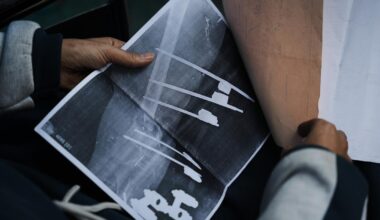 Gaza teen's chances of walking depend on Rafah crossing opening