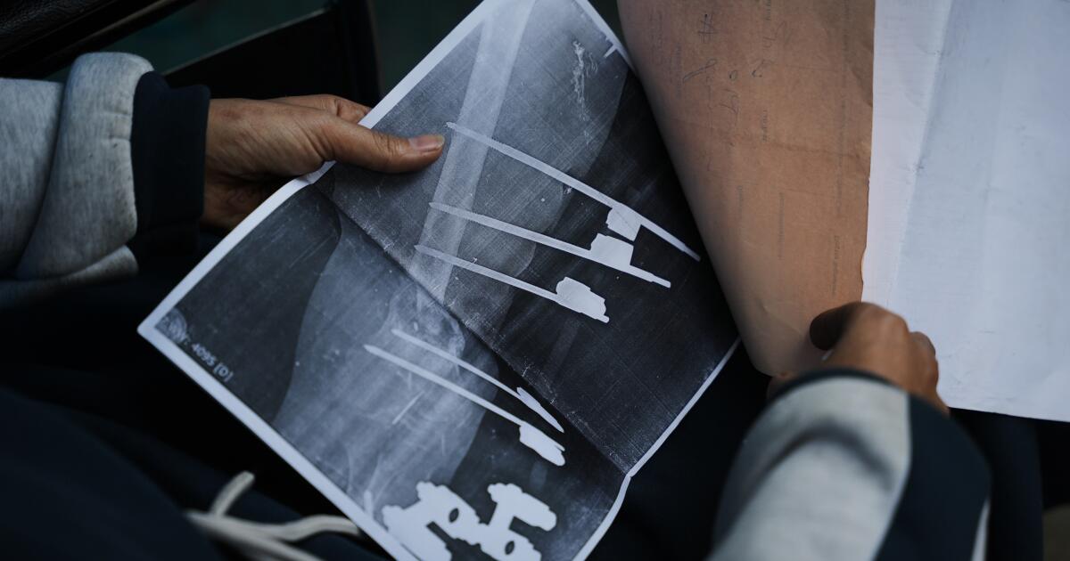 Gaza teen's chances of walking depend on Rafah crossing opening