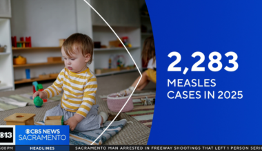 More than 100 Sacramento County children possibly exposed to measles