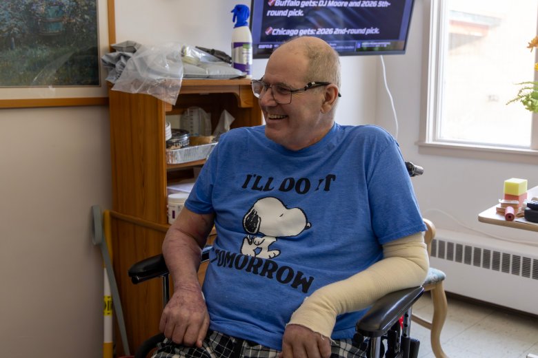 Oakland blast survivor talks about ‘miracle’ of being alive​​Oakland home explosion victim talks about his recovery