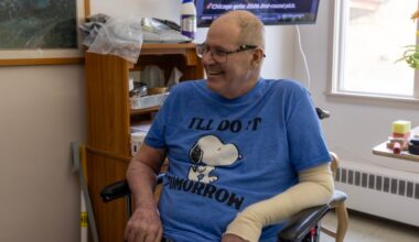 Oakland blast survivor talks about ‘miracle’ of being alive​​Oakland home explosion victim talks about his recovery