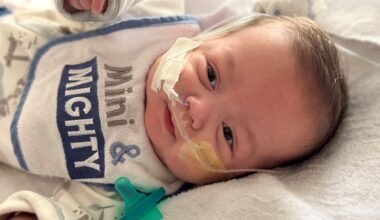 Nine months. Eighteen surgeries. One incredible homecoming for baby Sunny at Miller Children’s & Women’s Hospital • Brand stories