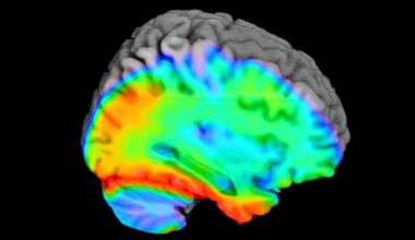 Blood test signals dementia risk in women before symptoms