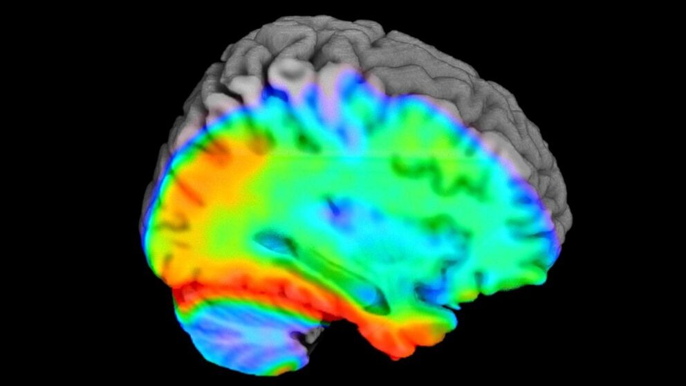 Blood test signals dementia risk in women before symptoms