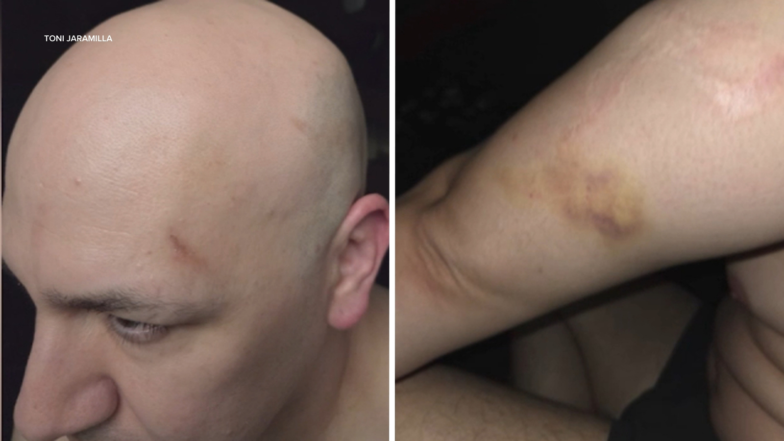 Man sues Los Angeles Police Department, alleging officers attacked him while he livestreamed ICE protest