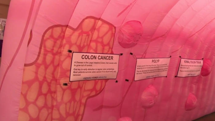 Colon cancer event in Oakland County stresses the importance of early testing