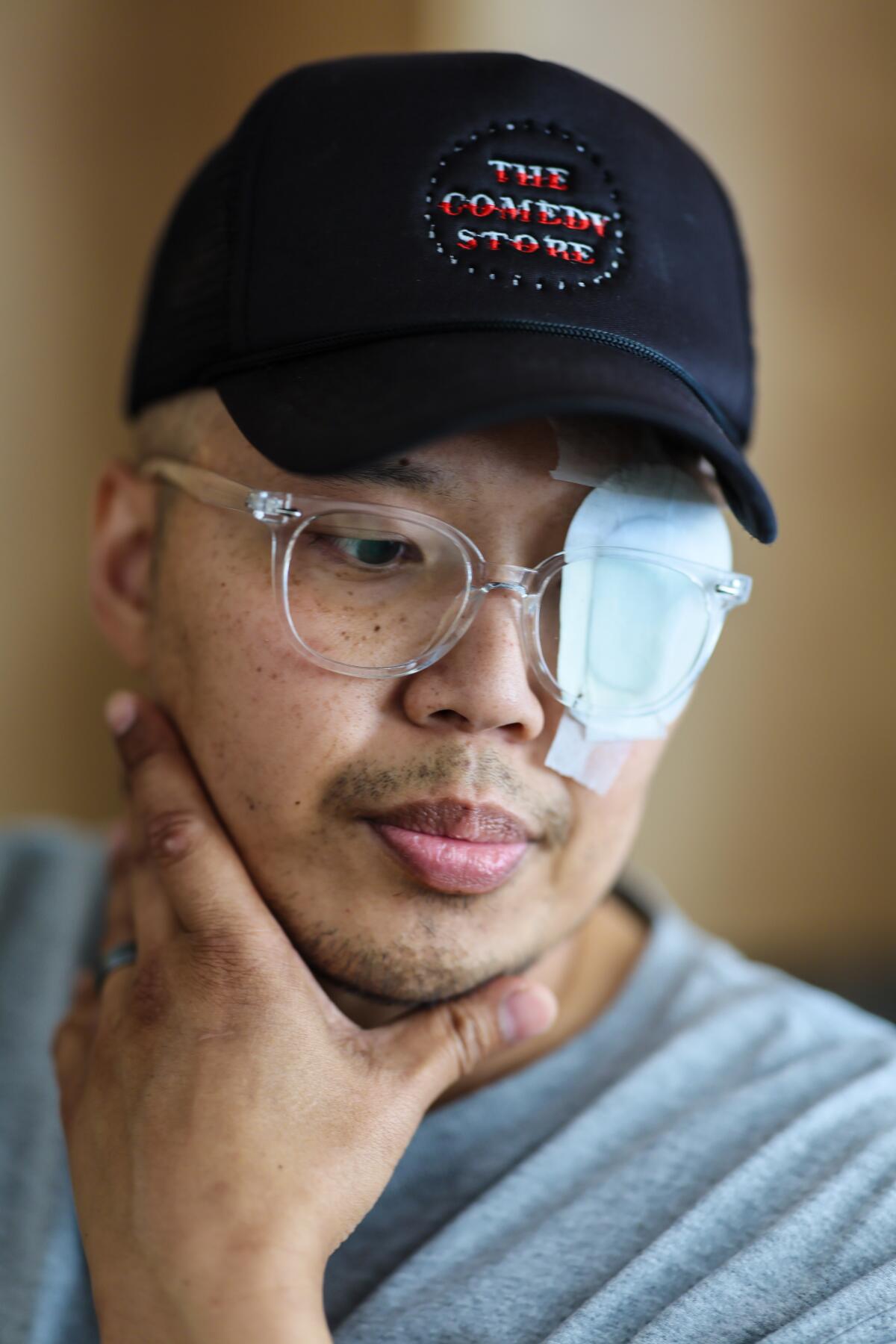 A man in a Comedy Store ballcap with a patch over one eye holding his chin with one hand