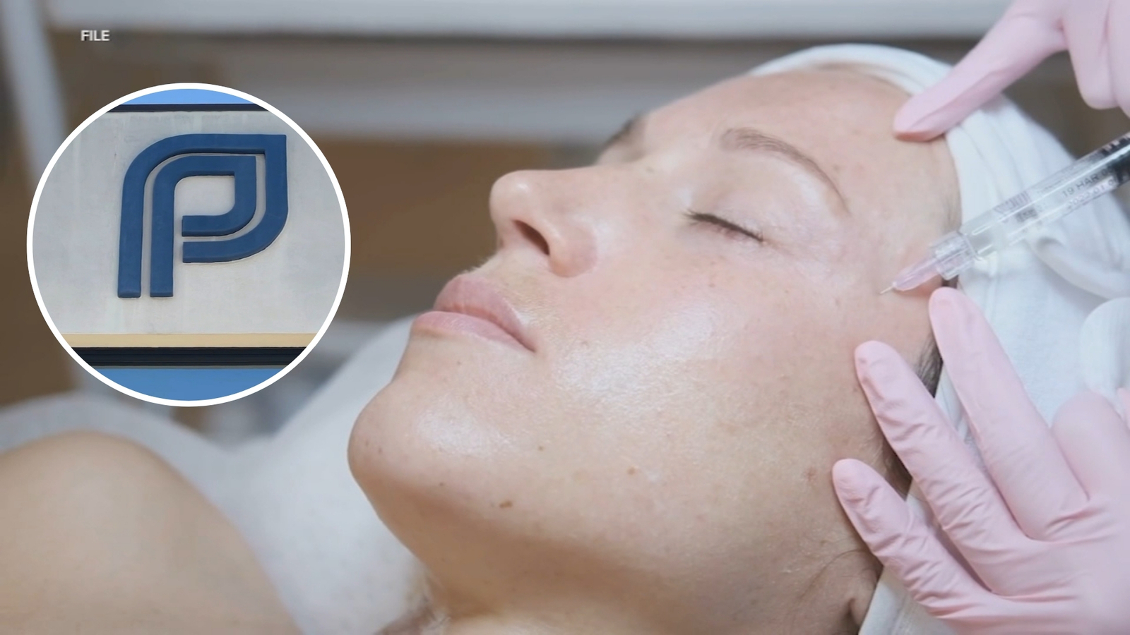 Botox at Planned Parenthood? Some California clinics expand services to include aesthetics