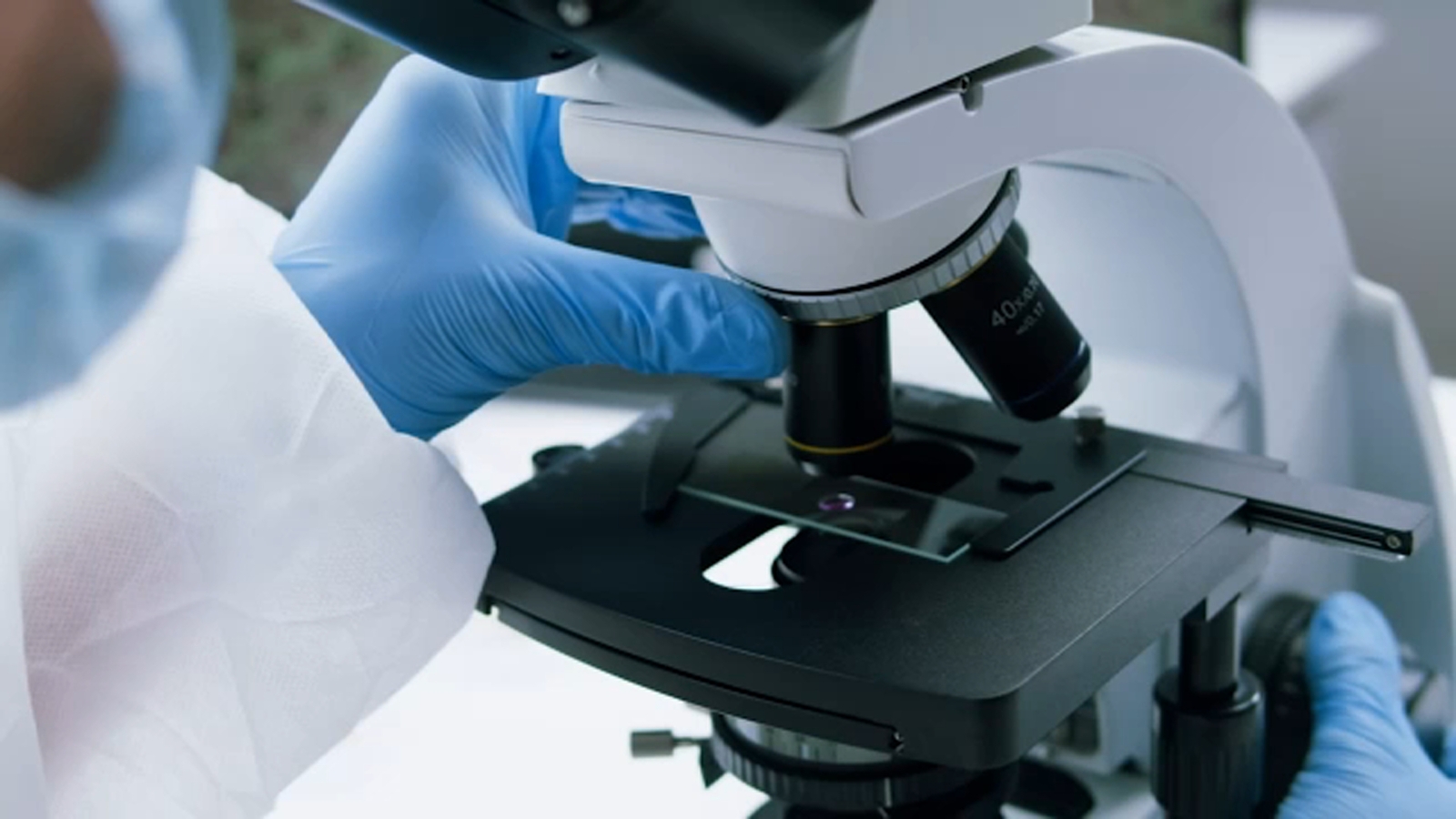 Central California health leaders monitor for tuberculosis, stressing testing and treatment