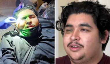 Man says LAPD shot projectile during anti-ICE protest that took his eye, files $100 million claim