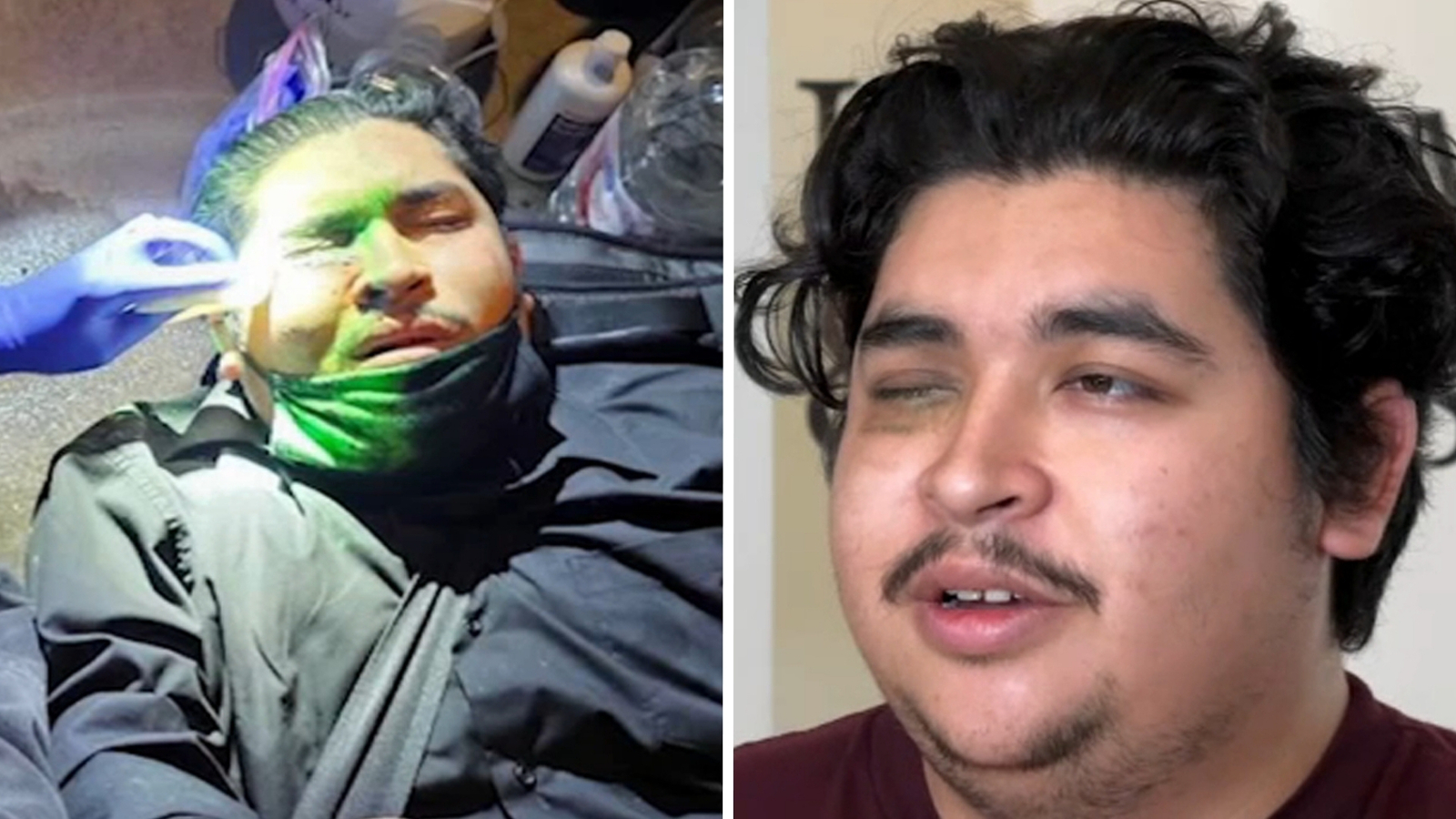 Man says LAPD shot projectile during anti-ICE protest that took his eye, files $100 million claim