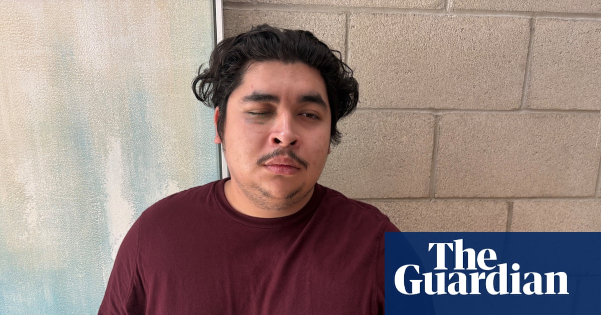 Los Angeles man blinded by officer’s projectile at anti-ICE protest, claim says | Los Angeles