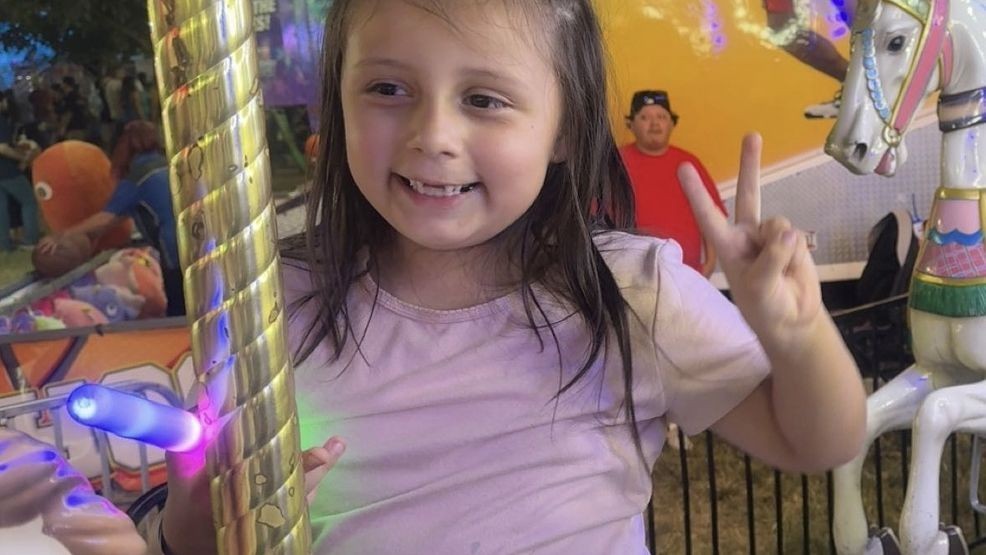 ABBY ORELLANA WAS KICKED IN THE FACE BY ANOTHER CHILD, HER MOTHER SAYS HAS BEEN CONSTANTLY BULLYING HER.{ }PHOTO CREDIT: SANDRA ORELLANA