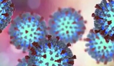 More than 100 children possibly exposed as measles outbreak spreads in Sacramento region