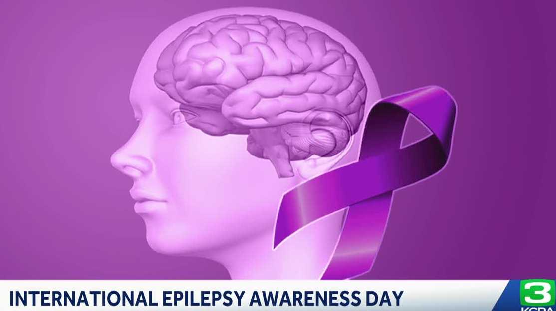'Seize the Moment' run in Sacramento set to bring awareness to epilepsy