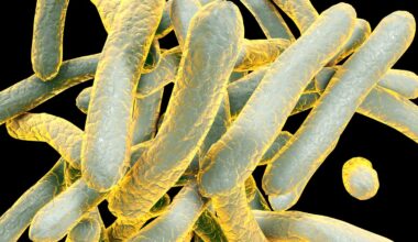 Drug-resistant tuberculosis exposure warning issued to worshippers at Miramar church – NBC 7 San Diego