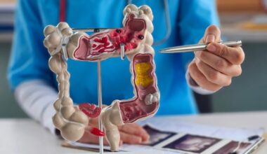 A gastroenterologist’s advice on how to prevent colorectal cancer – San Diego Union-Tribune