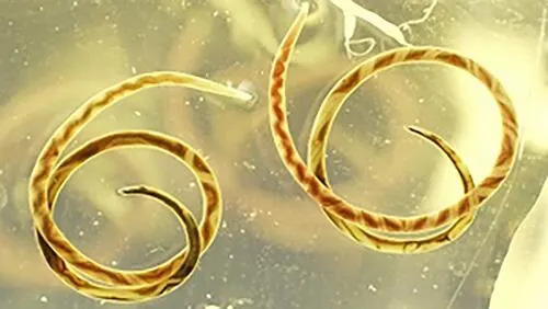Angiostrongylus is a parasite found in rats. It is also called rat lungworm.