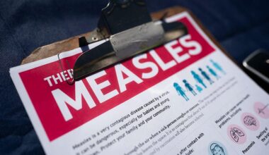 3 new Placer County measles cases believed tied to South Carolina outbreak