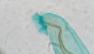 A Brain-Invading Worm Spread By Rats and Snails Has Reached California