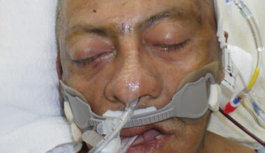 LA Hospital Seeks Help Identifying Man Involved in Vehicle Crash