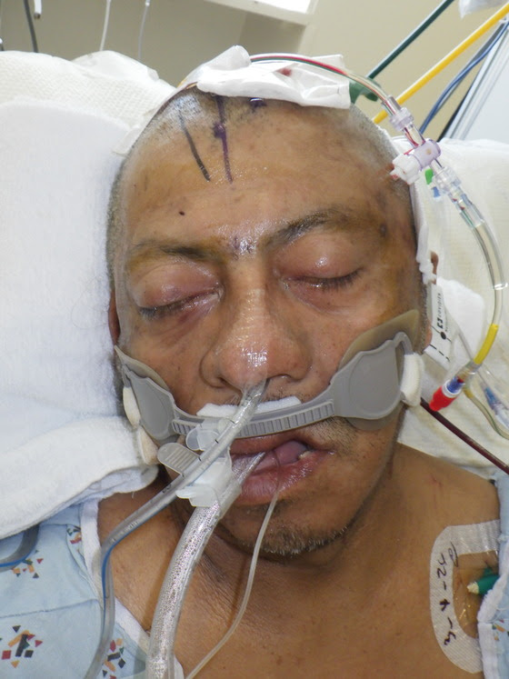 LA Hospital Seeks Help Identifying Man Involved in Vehicle Crash
