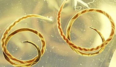 The neuro disease rat lungworm has reached California