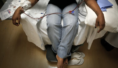 California law targeting dialysis clinics ruled unconstitutional
