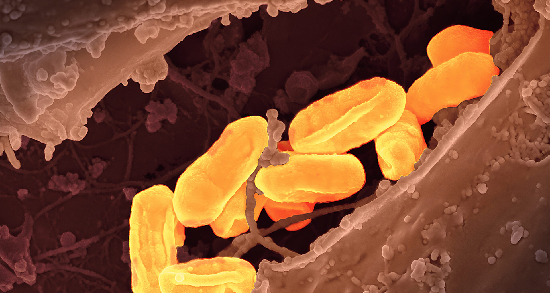 Dangerous disease 'old as the plague' hits record high in California