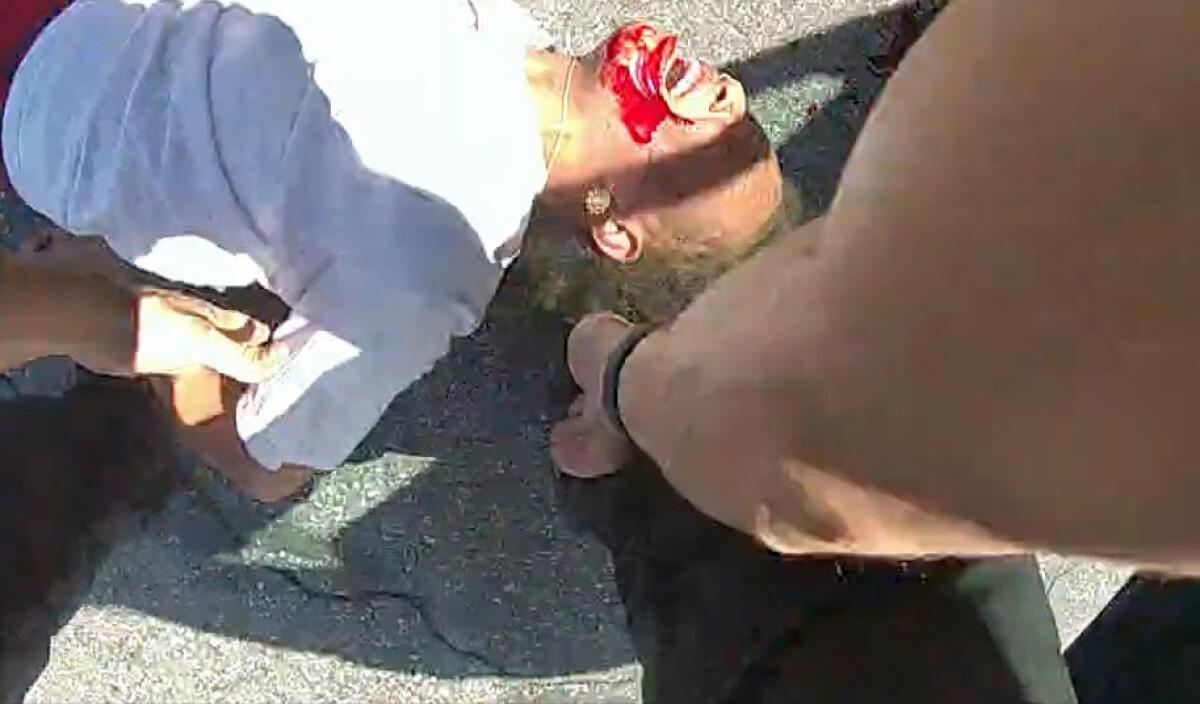 Lawsuit Alleges San Bernardino Officer Hip-Tossed Teen Girl, Face-First, Causing Brain Injury and Memory Loss.