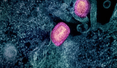 Health Officials Urge Vaccinations After New Case Of Monkeypox Reported