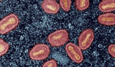 SF Department of Public Health confirms first clade I mpox case