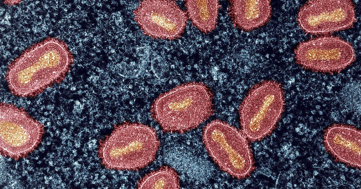 SF Department of Public Health confirms first clade I mpox case