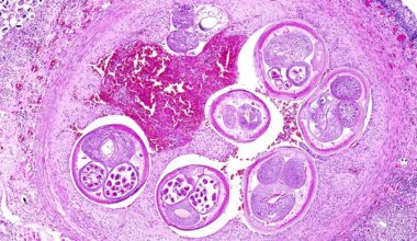 A Brain-Infecting Parasite Has Come to California. Should Santa Barbara Worry?